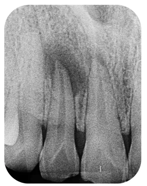 Best Dentist in Mysore